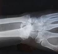 X-Ray, MRI, Medical imaging image